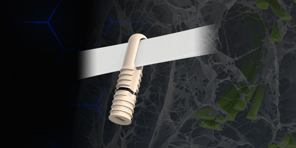 Hercules XE Kit with BioBrace