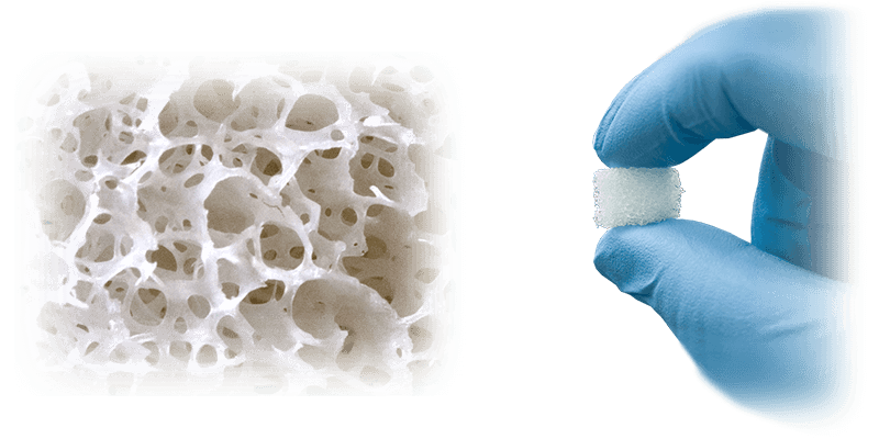 masilla para huesos alloaid