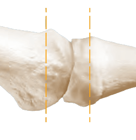 RTS First Strait Cut