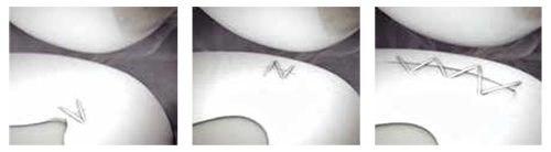 sequent repair configurations