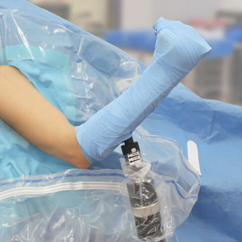 showing the AssistArm in the Beach Chair position